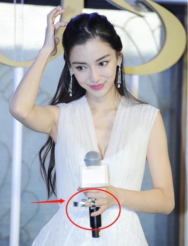 哪些明星骨折过,哪些明星骨折过？大自然之旅中的意外与坚持